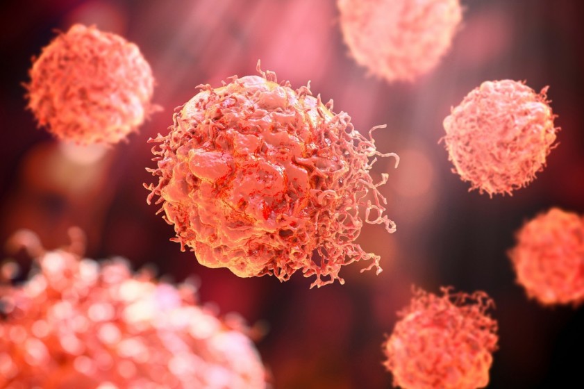 Rielaborazione al computer di un’immagine di cellule tumorali maligne (foto dell’agenzia Shutterstock) 