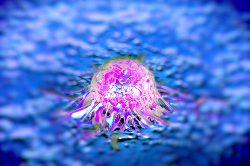 Cellule di tumore della prostata osservate tramite la microscopia elettronica a scansione (foto Shutterstock)